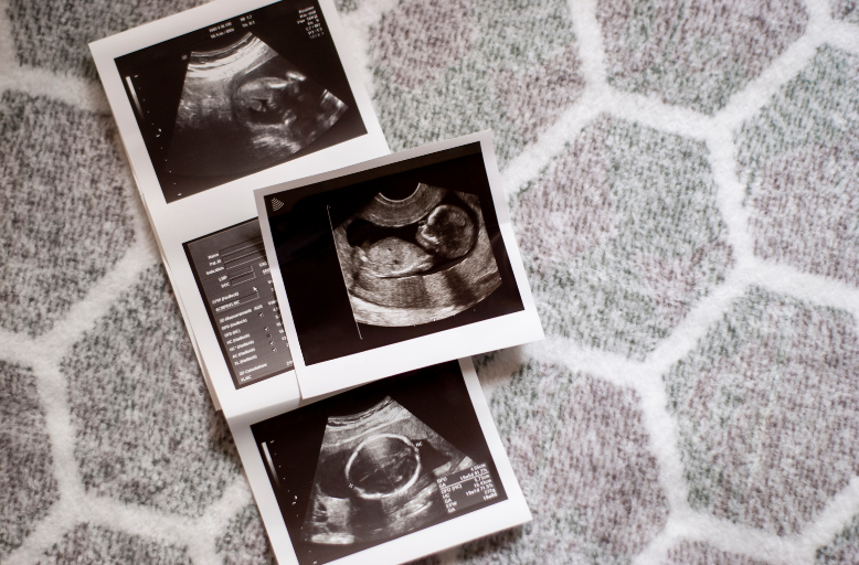 Badania prenatalne 1 trymestr